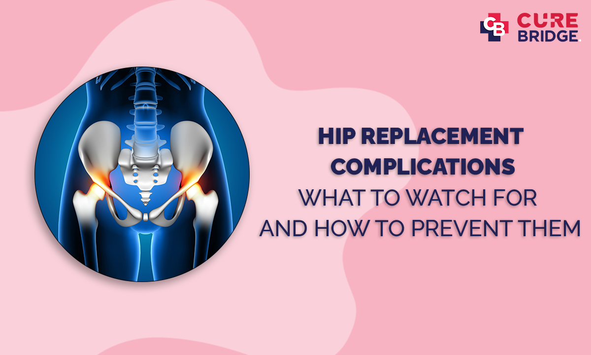 Hip Replacement Complications: what to watch for and how to prevent them