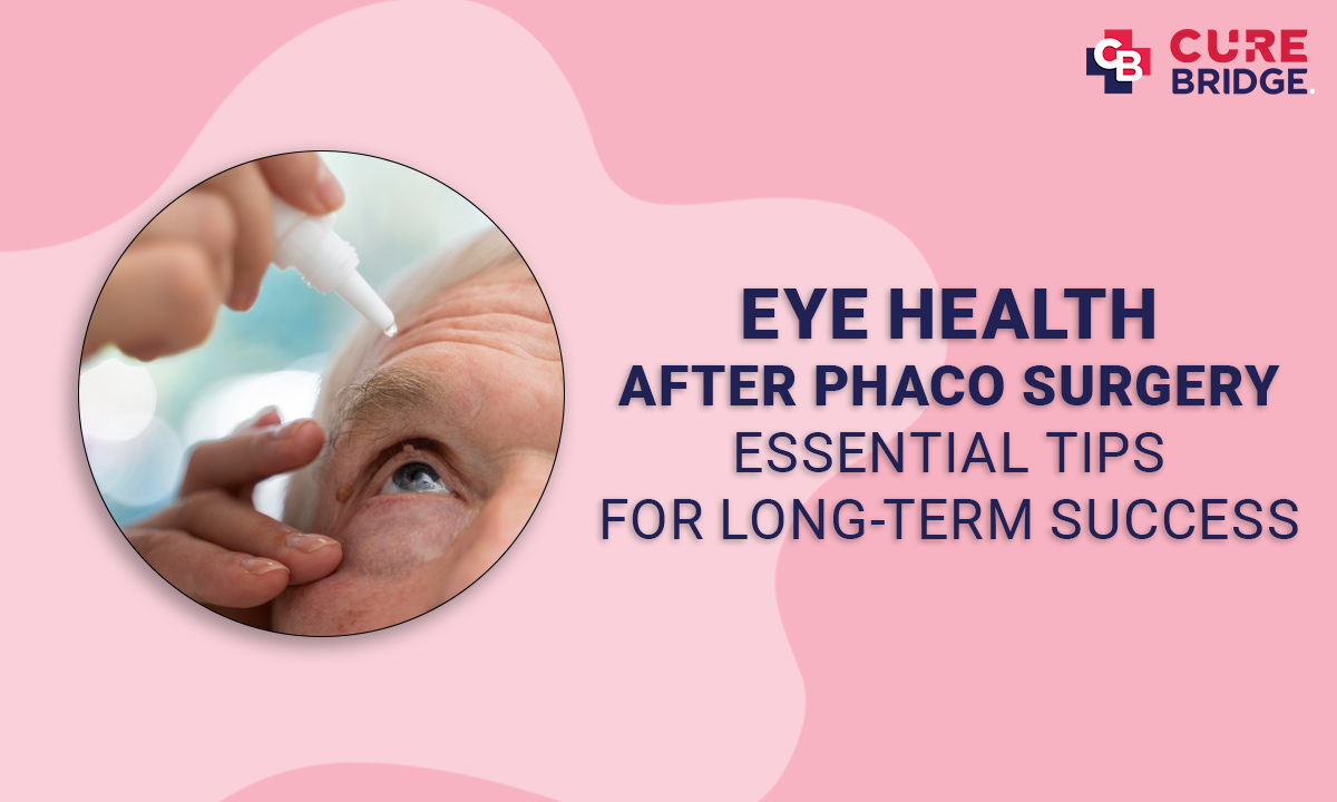 Eye Health After Phaco Surgery: Essential Tips for Long-Term Success