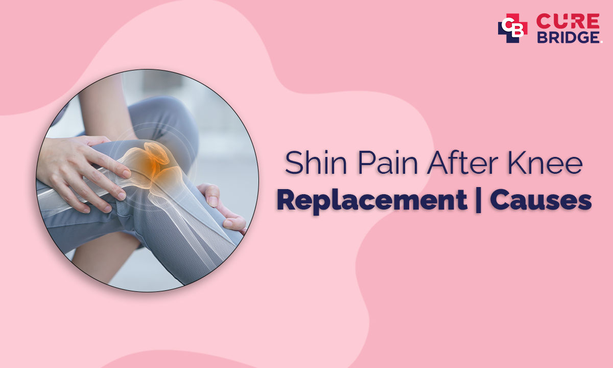 Shin Pain After Knee Replacement | Causes