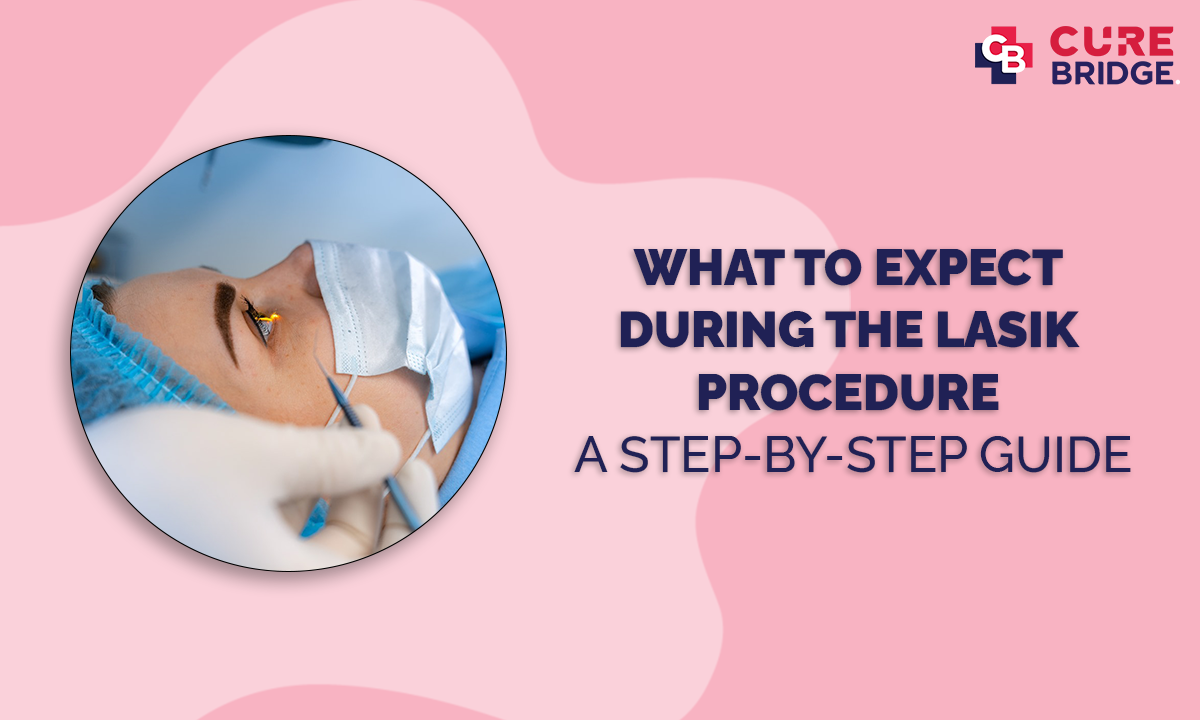 What to expect during the LASIK procedure: a step-by-step guide