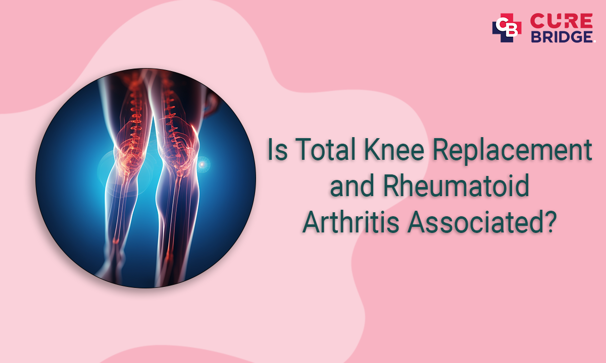 Is Total Knee Replacement and Rheumatoid Arthritis Associated?