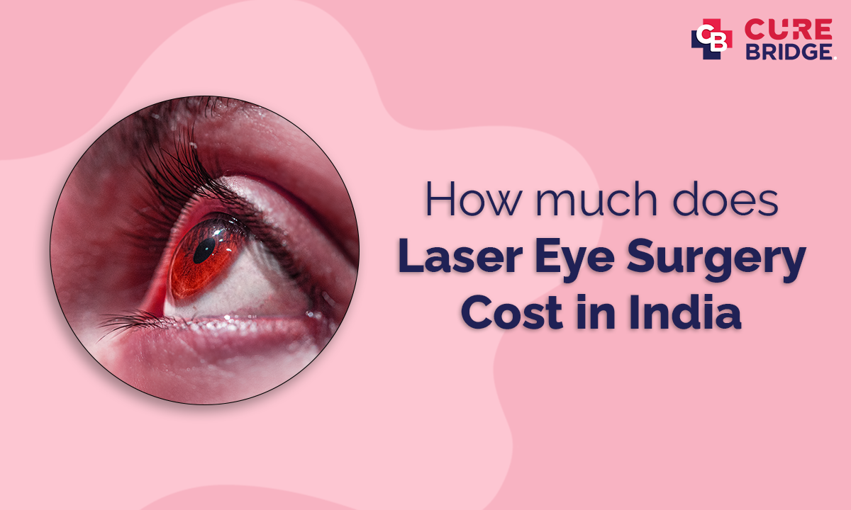 How much does Laser Eye Surgery Cost in India?