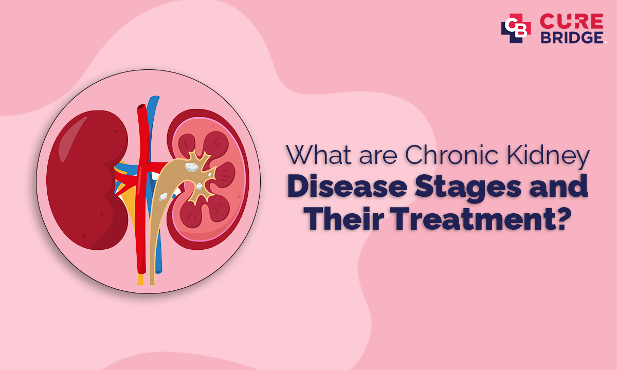 What Are Chronic Kidney Disease Stages And Their Treatment?
