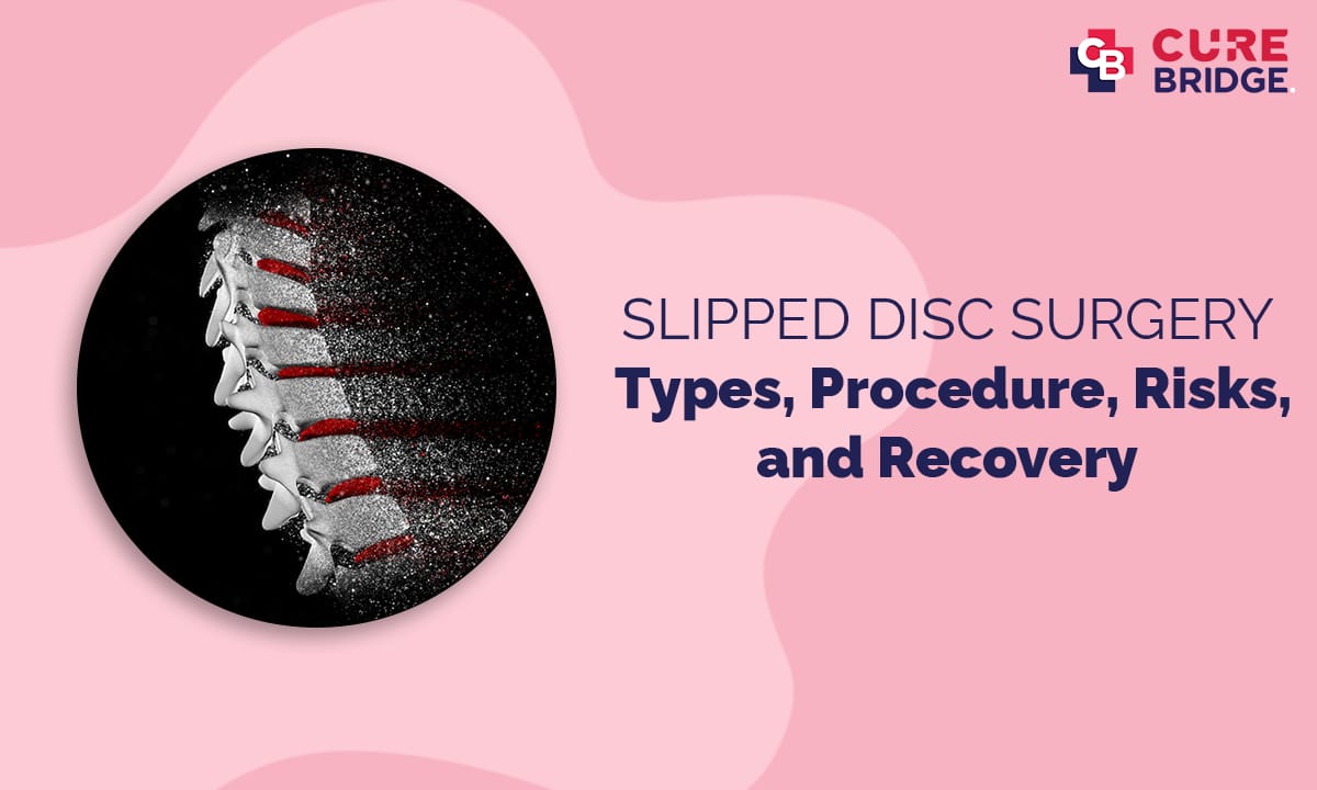 Slipped Disc Surgery: Types, Procedure, Risks, and Recovery