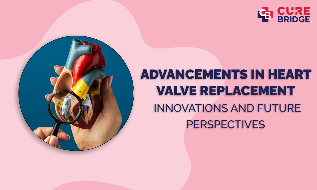 Advancements in Heart Valve Replacement: Innovations and Future Perspectives