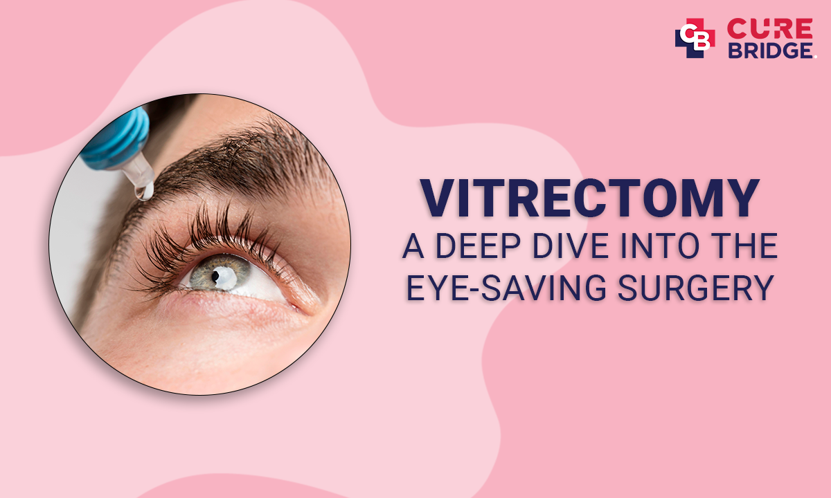 Vitrectomy: A Deep Dive into the Eye-Saving Surgery