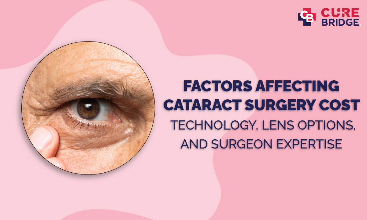 Factors Affecting Cataract Surgery Cost: Technology, Lens Options, and Surgeon Expertise