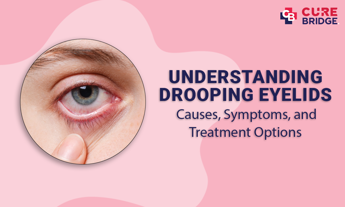 Understanding Drooping Eyelids: Causes, Symptoms, and Treatment Options