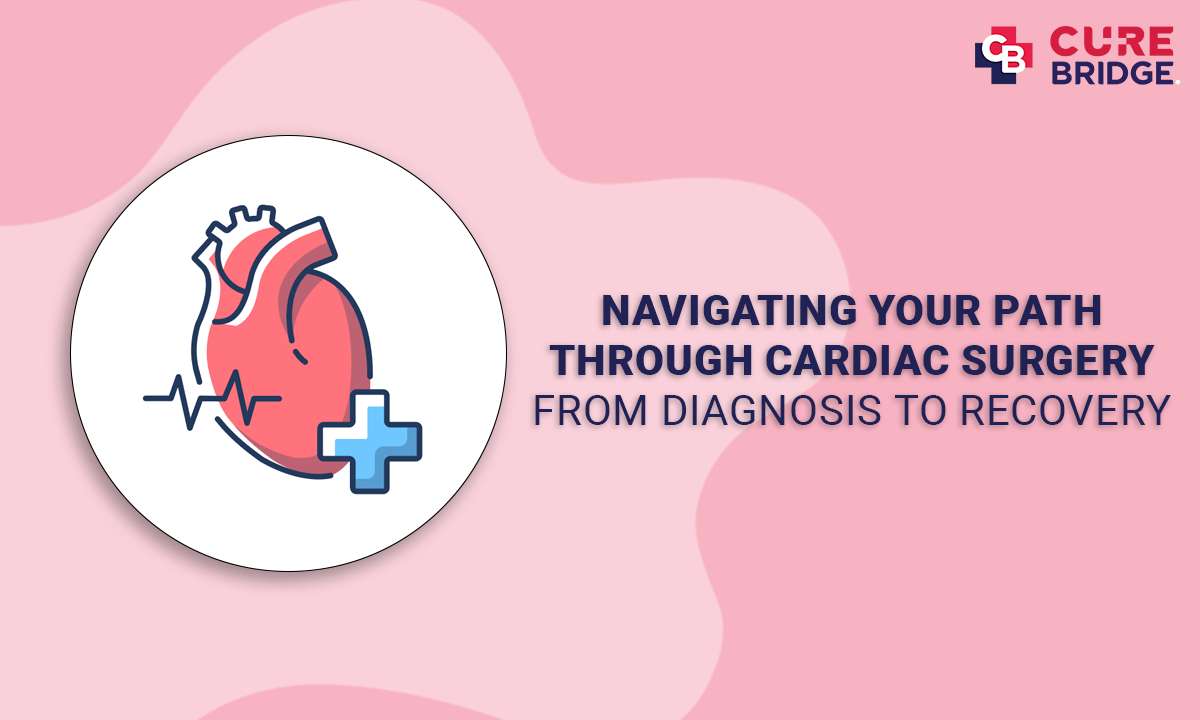 Navigating Your Path Through Cardiac Surgery: From Diagnosis to Recovery