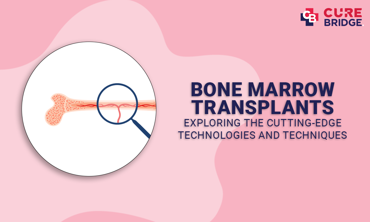 Bone Marrow Transplants: Exploring the Cutting-edge Technologies and Techniques