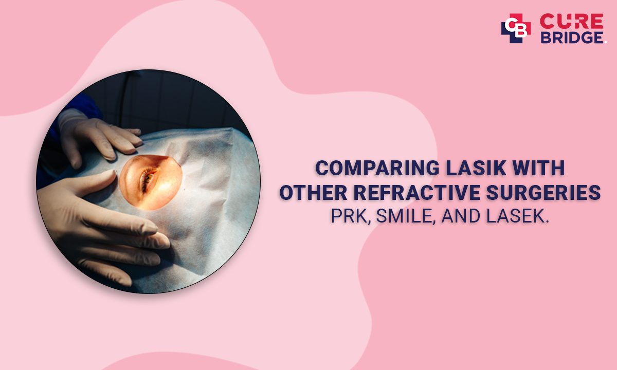 Comparing LASIK with Other Refractive Surgeries: PRK, SMILE, and LASEK