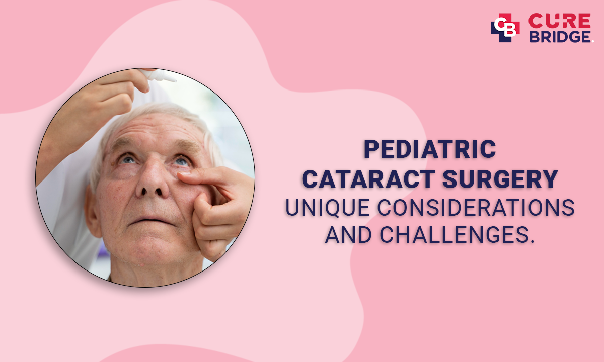 Pediatric Cataract Surgery: Unique Considerations and Challenges