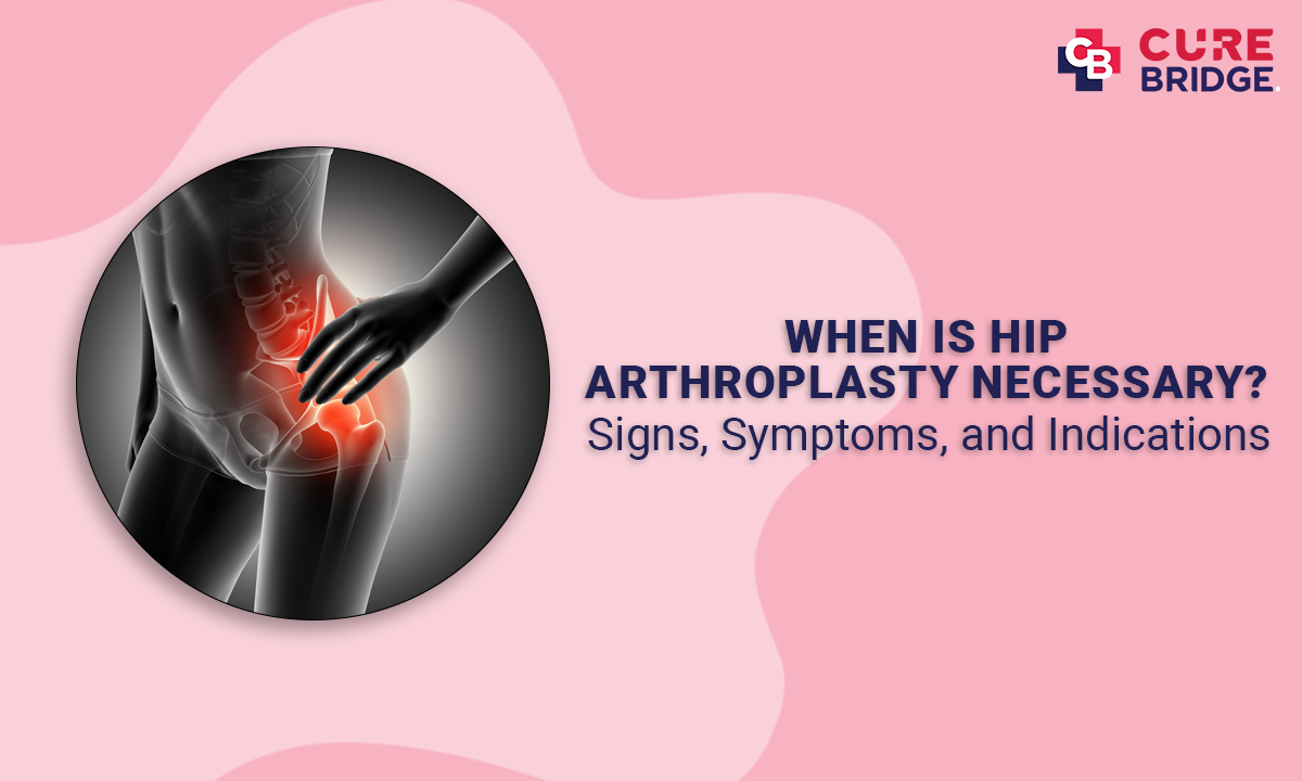When is Hip Arthroplasty Necessary? Signs, Symptoms, and Indications