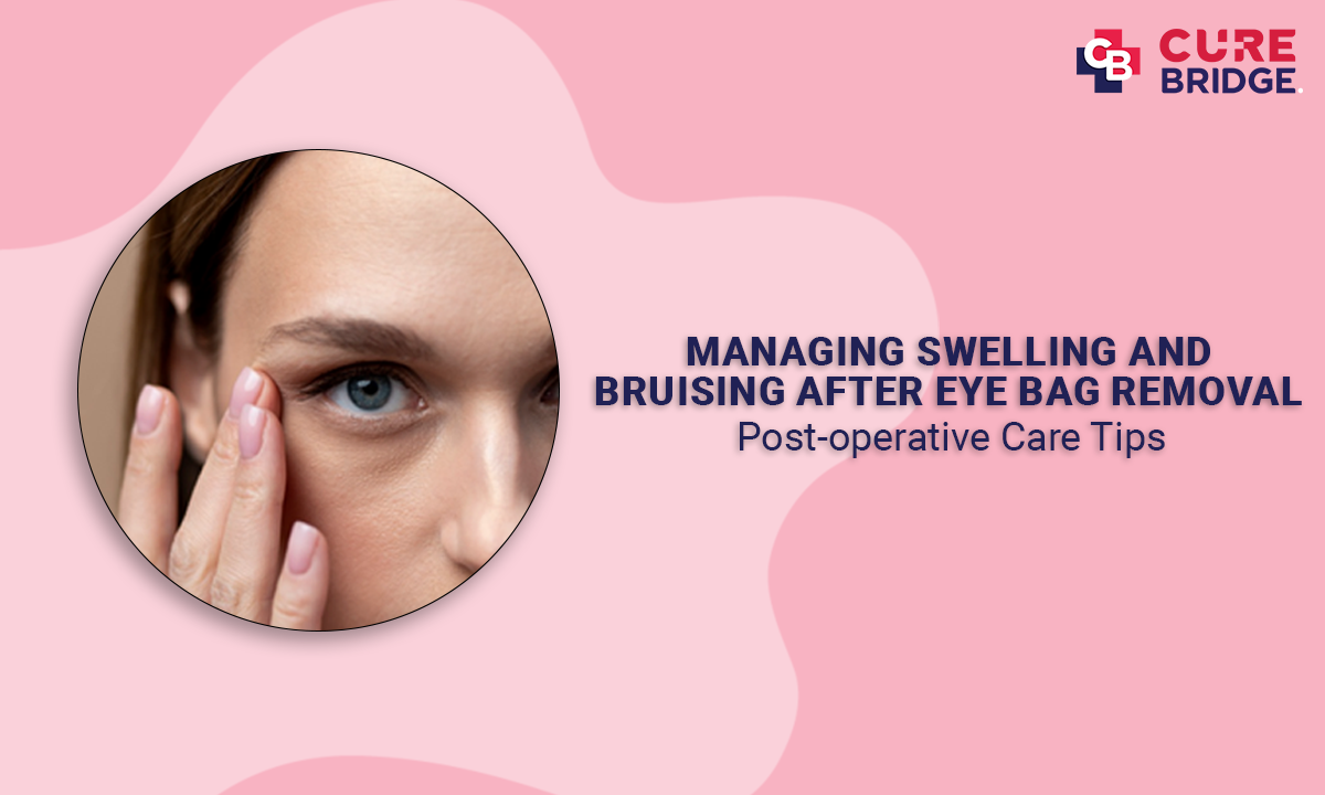 Managing Swelling and Bruising after Eye Bag Removal: Post-operative Care Tips