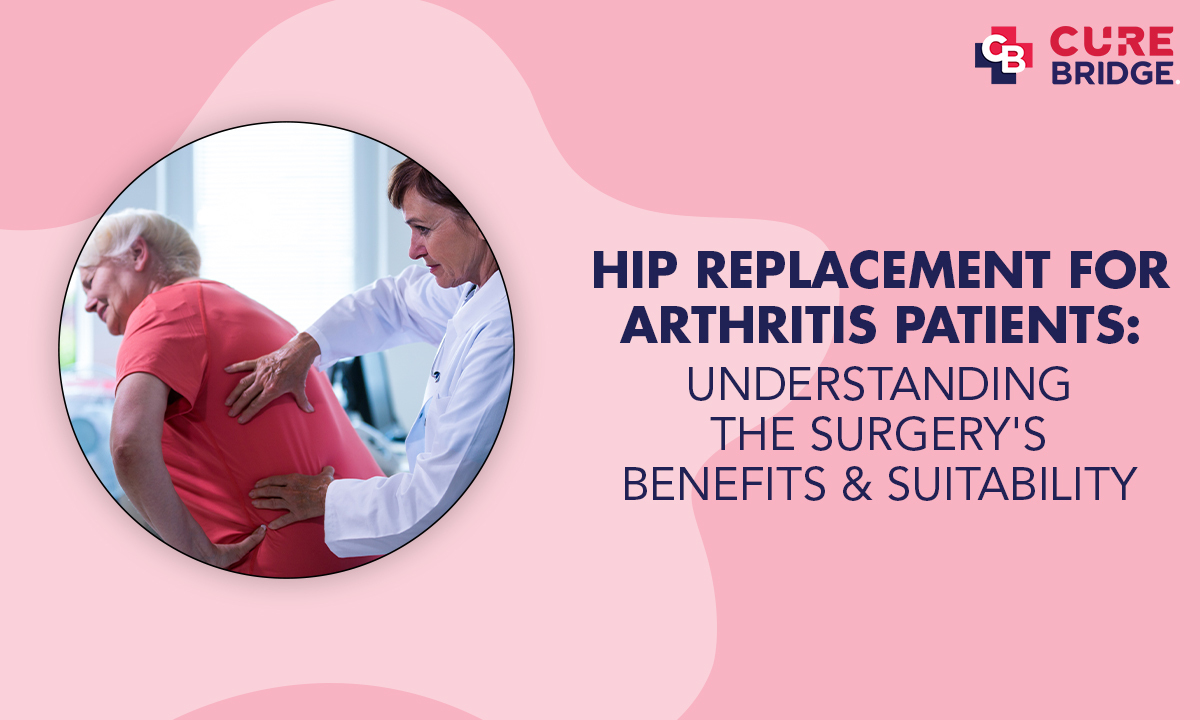 Hip Replacement Surgery for Arthritis Patients: Understanding the Benefits and Suitability