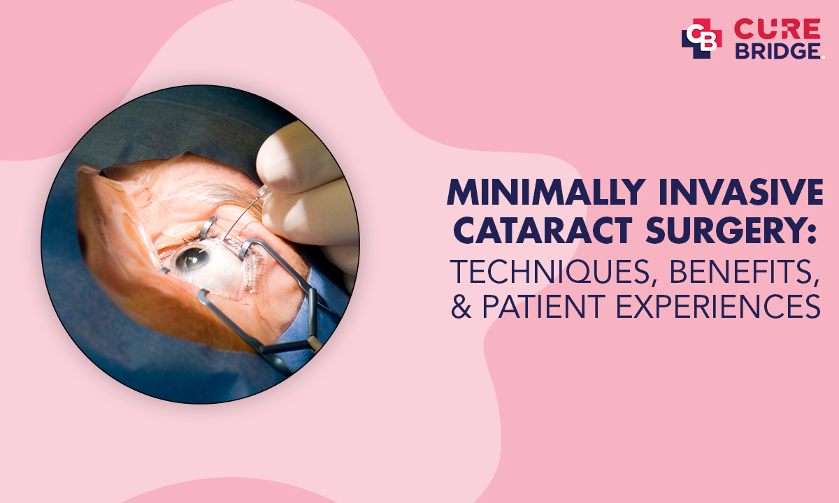 Minimally Invasive Cataract Surgery: Techniques, Benefits, and Patient Experiences