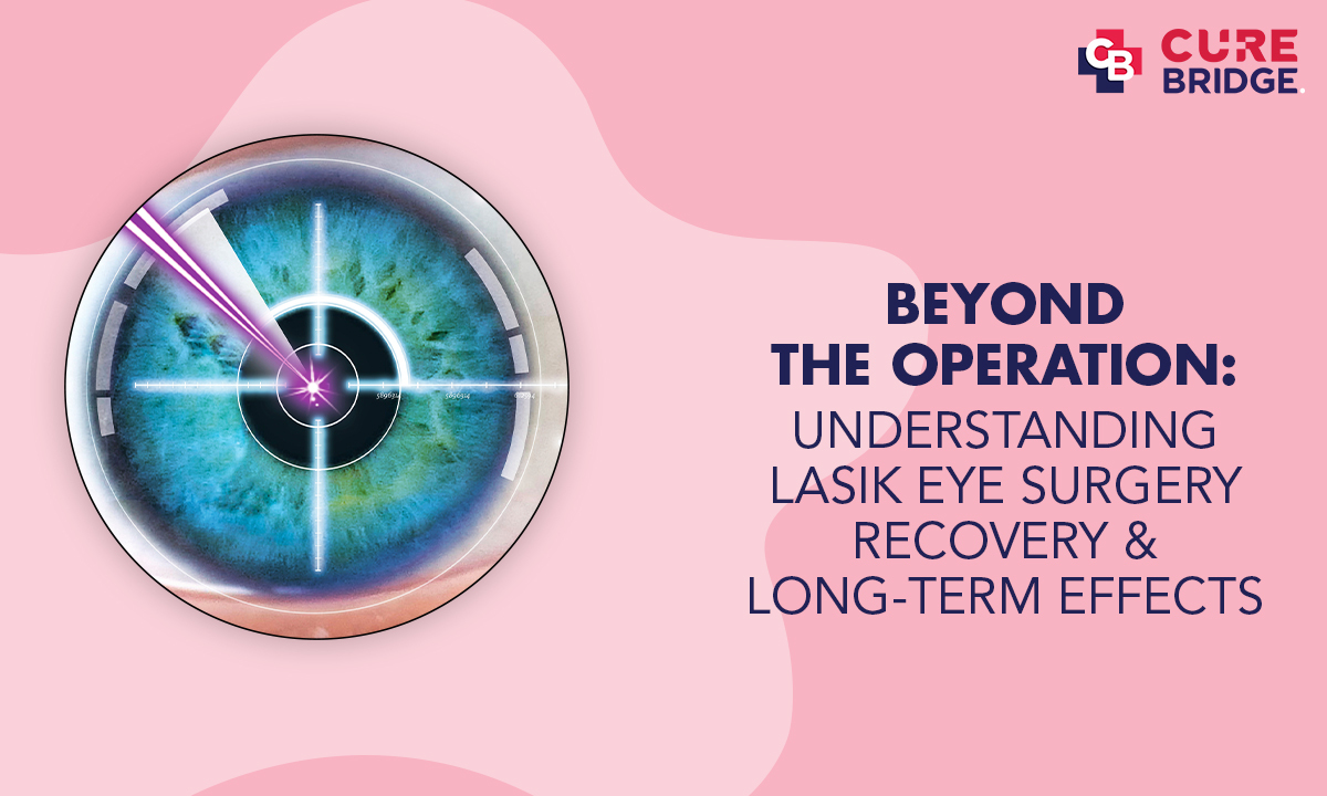 Beyond the Operation: Understanding LASIK Eye Surgery Recovery and Long-Term Effects