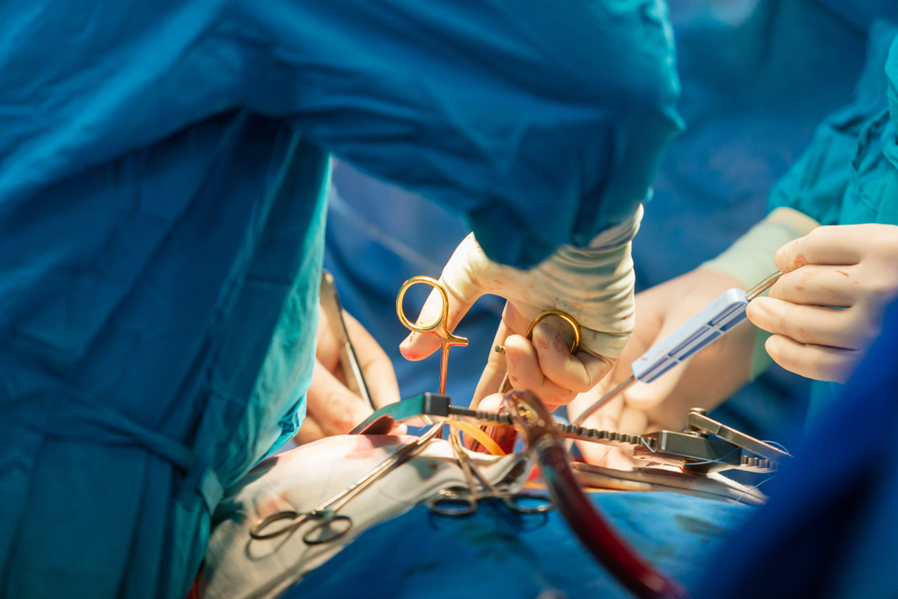 cardiac surgery