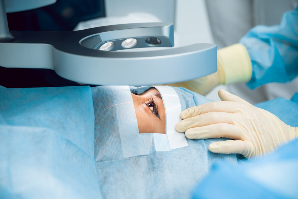 cataract surgery