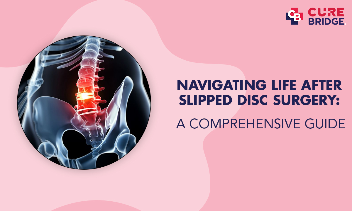 Navigating Life After Slipped Disc Surgery: A Comprehensive Guide