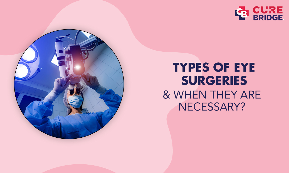 Types of Eye Surgeries and When They Are Needed