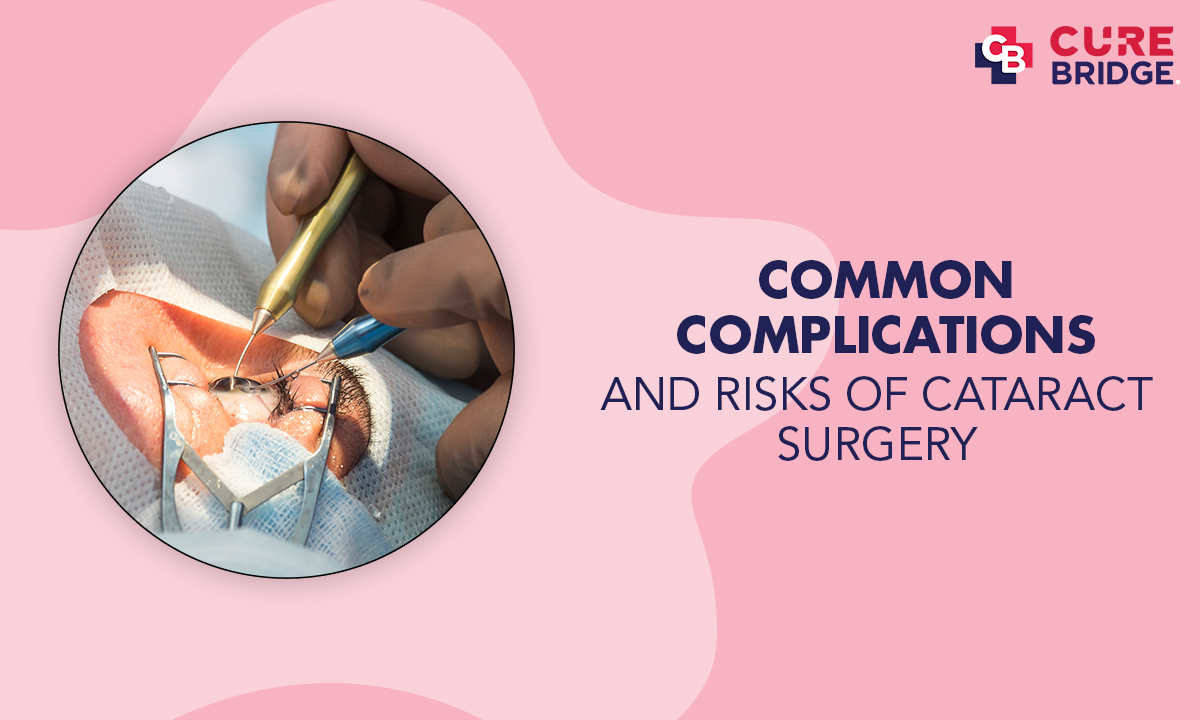 Common Complications and Risks of Cataract Surgery