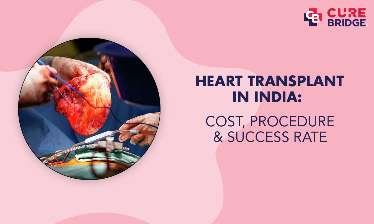 Heart Transplant in India: Cost, Procedure and Success Rate