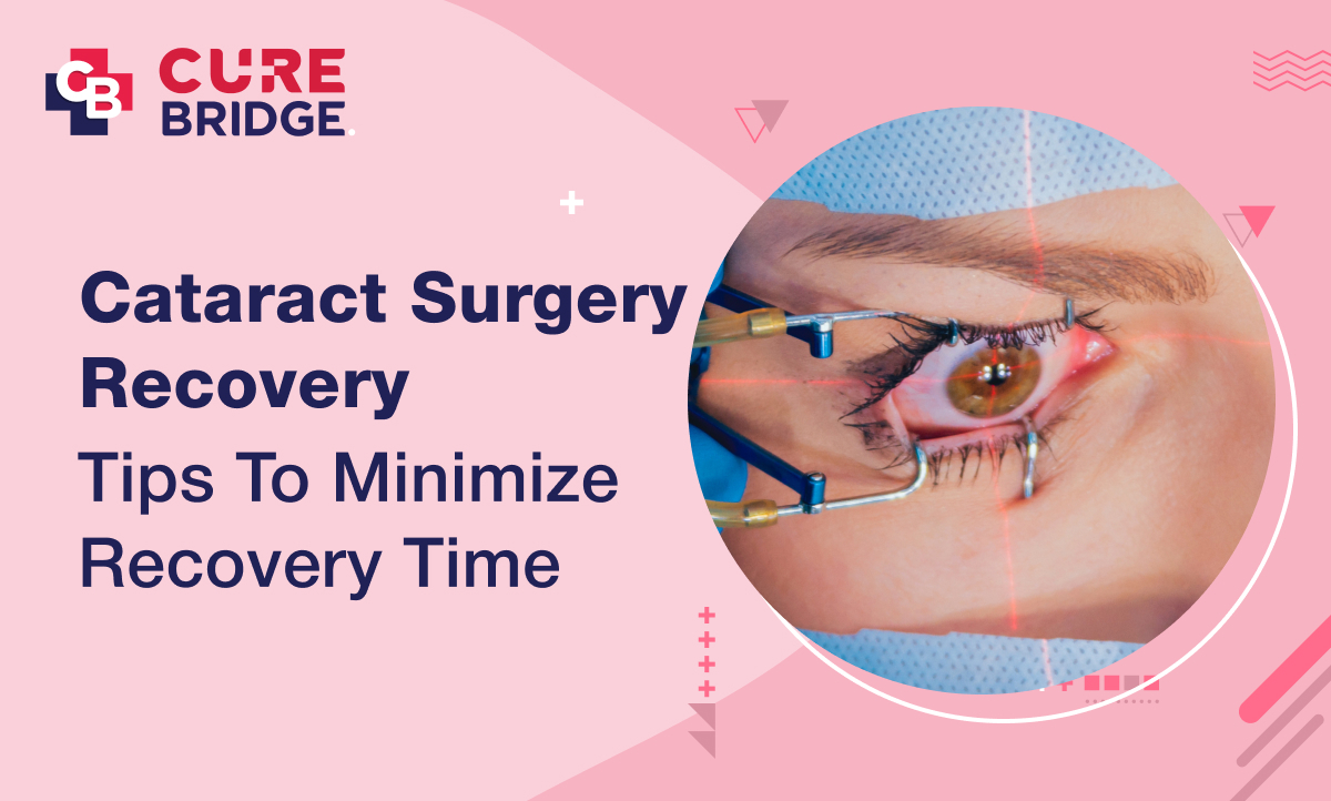 Cataract Surgery Recovery: Tips to Minimize Recovery Time