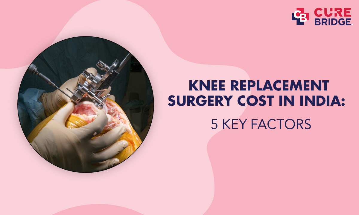 Knee Replacement Surgery Cost in India: 5 key factors