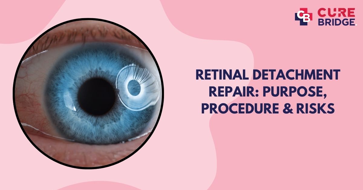 Retinal Detachment Repair: Purpose, Procedure & Risks