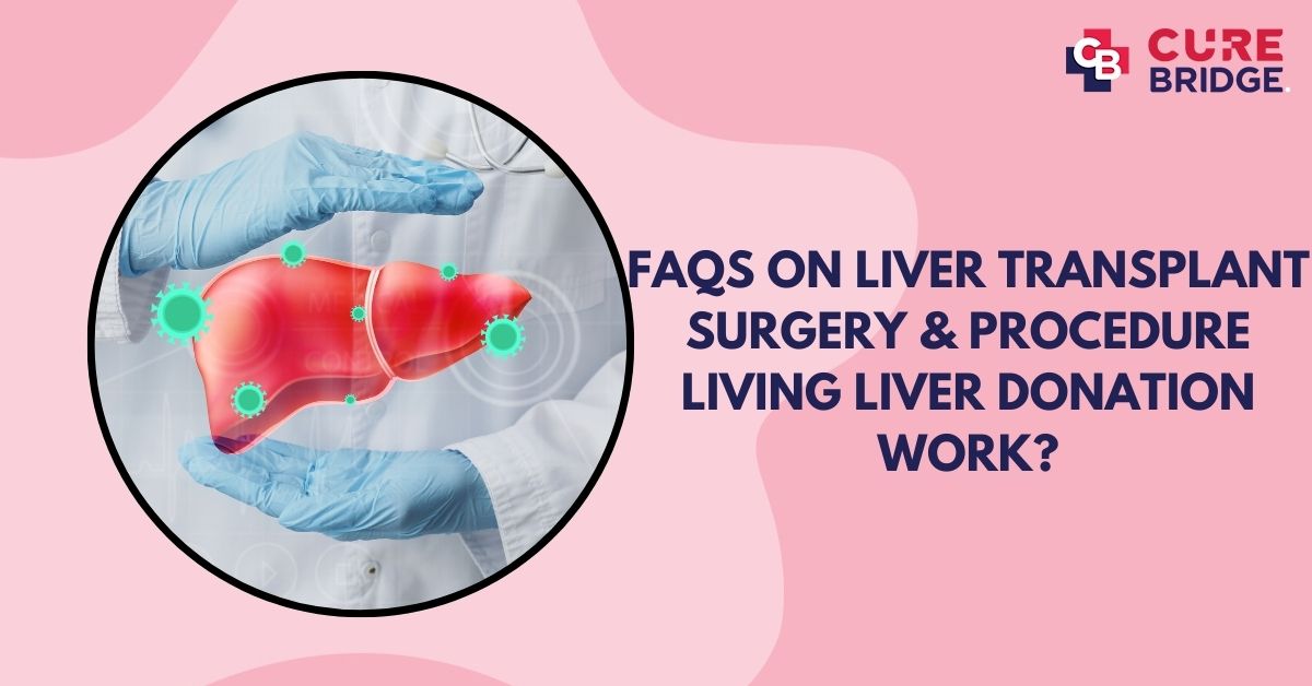 FAQs on Liver Transplant Surgery & Procedure