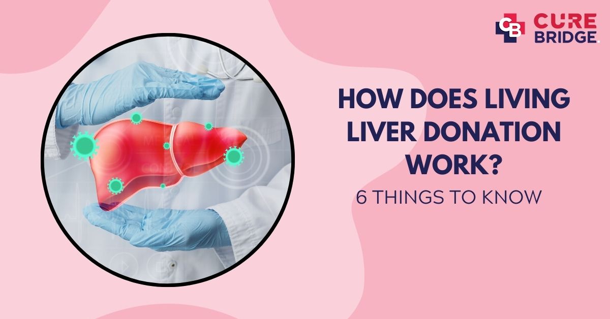 How Does Living Liver Donation Work? 6 Things to Know