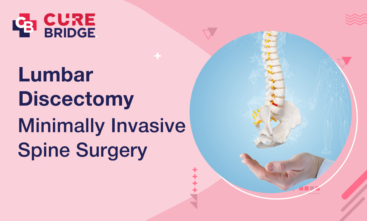 Lumbar Discectomy: Minimally Invasive Spine Surgery