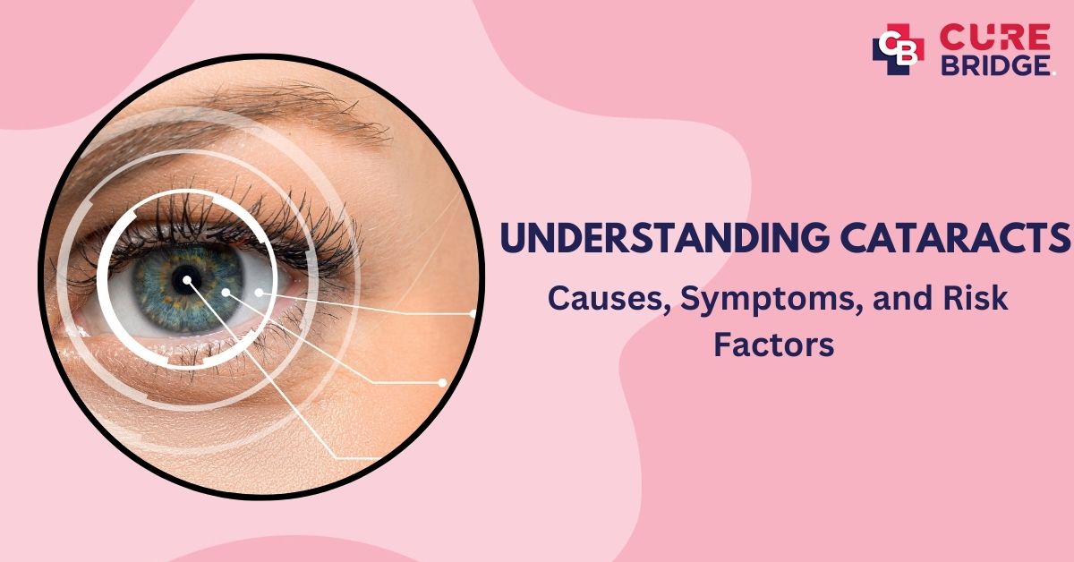 Understanding Cataracts: Causes, Symptoms, and Risk Factors