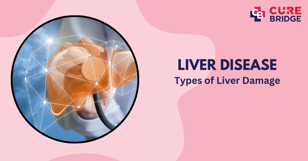 Liver Disease: Types of Liver Damage