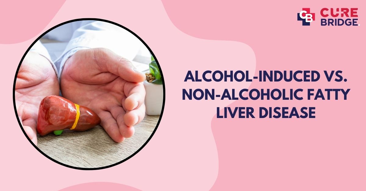 Alcohol-Induced vs. Non-Alcoholic Fatty Liver Disease