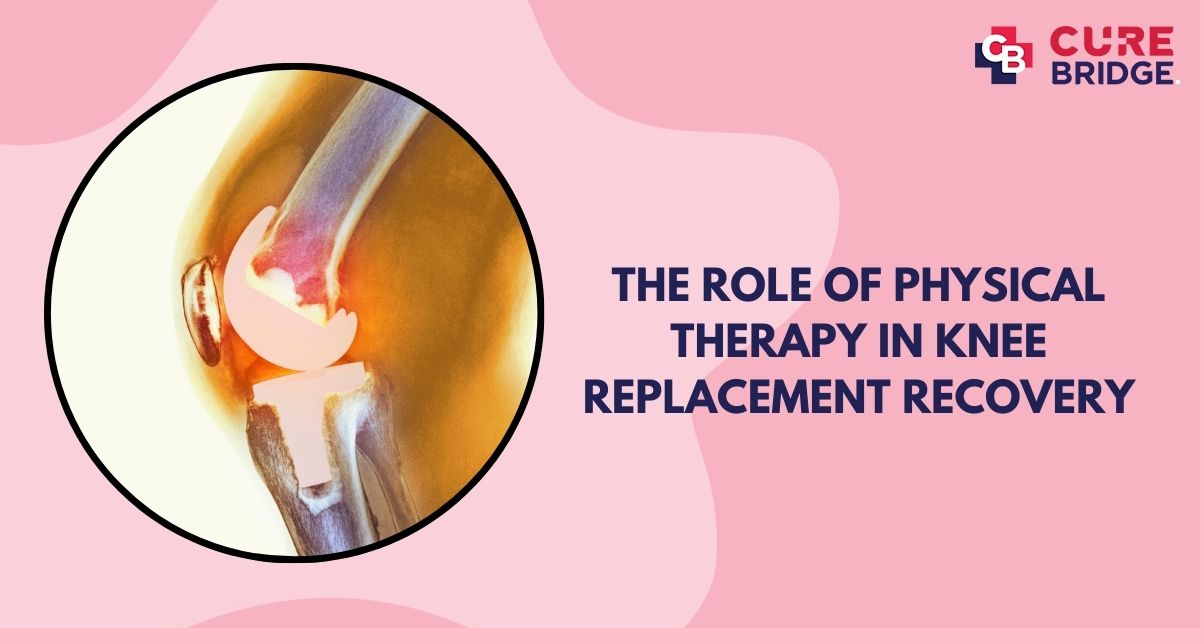 The Role of Physical Therapy in Knee Replacement Recovery