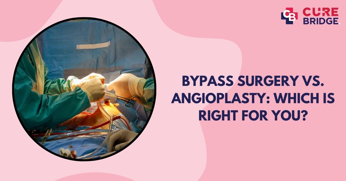 Bypass Surgery vs. Angioplasty: Which is Right for You?