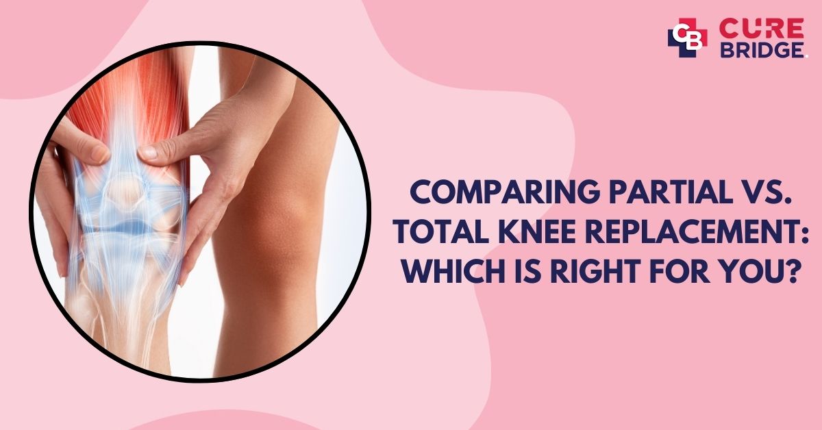 Comparing Partial vs. Total Knee Replacement: Which is Right for You?