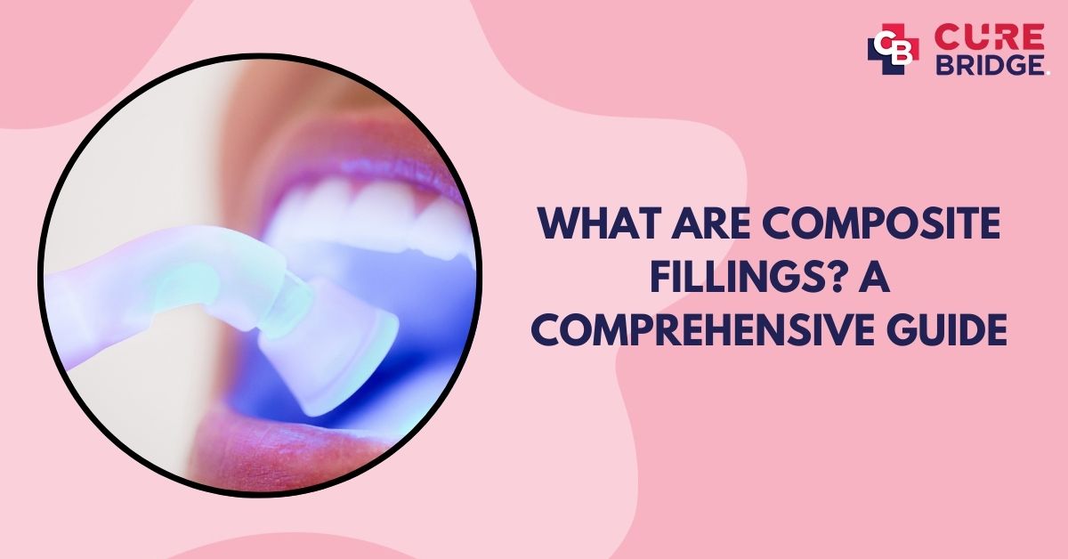 What Are Composite Fillings? A Comprehensive Guide