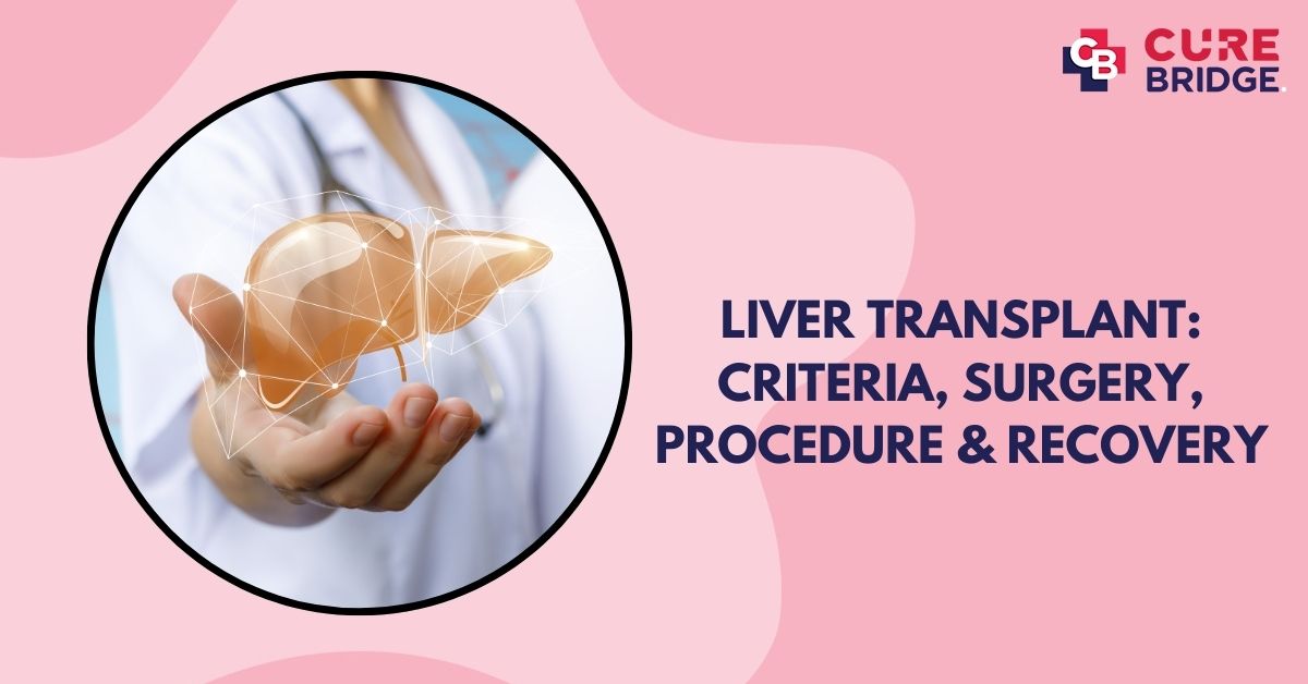 Liver Transplant: Criteria, Surgery, Procedure & Recovery