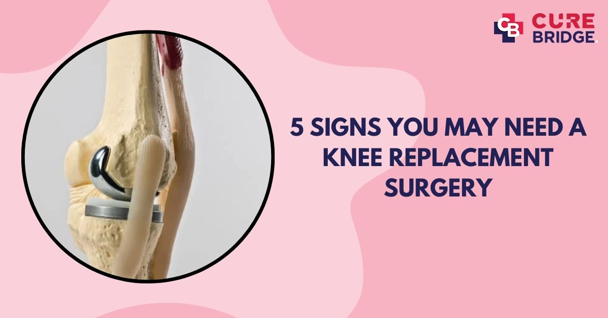 5 Signs You May Need a Knee Replacement Surgery